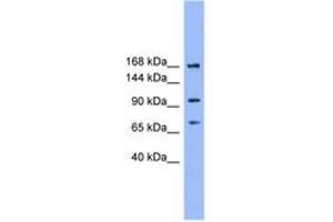 Image no. 1 for anti-ADAM Metallopeptidase with Thrombospondin Type 1 Motif, 19 (ADAMTS19) (N-Term) antibody (ABIN6746174) (ADAMTS19 antibody  (N-Term))