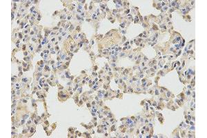 Immunohistochemistry (IHC) image for anti-Neural Wiskott-Aldrich syndrome protein (WASL) antibody (ABIN1875345) (Neural Wiskott-Aldrich syndrome protein (WASL) antibody)