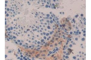 Detection of IL5Ra in Mouse Testis Tissue using Polyclonal Antibody to Interleukin 5 Receptor Alpha (IL5Ra)