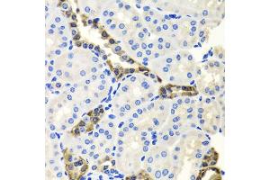 Immunohistochemistry of paraffin-embedded mouse kidney using ENDOG antibody. (Endonuclease G antibody)