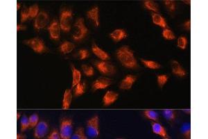 Immunofluorescence analysis of HeLa cells using C1 Inactivator Polyclonal Antibody at dilution of 1:100. (SERPING1 antibody)