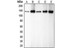 Western blot analysis of E Cadherin expression in HEK293T (A), PC12 (B), A431 (C), MCF7 (D), C2C12 (E) whole cell lysates. (E-cadherin antibody  (C-Term))