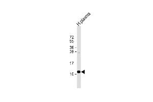 Anti-OA2 Antibody (Center) at 1:1000 dilution + human plasma lysate Lysates/proteins at 20 μg per lane. (APOA2 antibody  (AA 28-56))