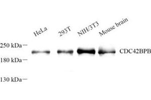 Western blot analysis of Cdc42bpb (ABIN7073411) at dilution of 1: 500