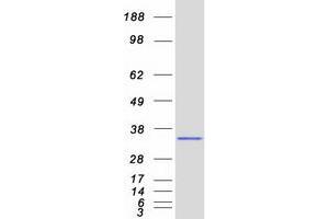 Validation with Western Blot (ORC6 Protein (Myc-DYKDDDDK Tag))