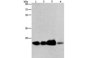 Western Blot analysis of 293T cell and Human fetal liver tissue, Human cervical cancer and fetal muscle tissue using ARFRP1 Polyclonal Antibody at dilution of 1:800