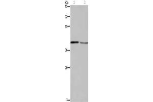Gel: 8 % SDS-PAGE, Lysate: 40 μg, Lane 1-2: Mouse small intestine tissue, Mouse skin tissue, Primary antibody: ABIN7129190(DEGS1 Antibody) at dilution 1/450, Secondary antibody: Goat anti rabbit IgG at 1/8000 dilution, Exposure time: 5 minutes (DEGS1 antibody)