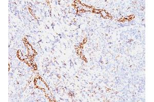 Formalin-fixed, paraffin-embedded human Tonsil stained with VEGF Mouse Monoclonal Antibody (VEGF/1063).