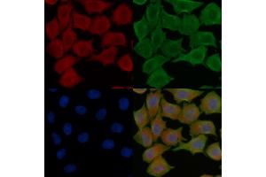ABIN7094821 and ABIN7098872 staining Hela cells(45 min of heat-shock treatment) by IF/ICC.