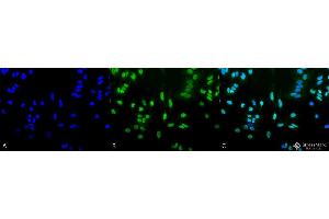 Immunocytochemistry/Immunofluorescence analysis using Rabbit Anti-Acetylated Lysine Polyclonal Antibody . (Lysine (lys) (acetylated) antibody (Biotin))