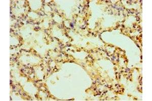 Immunohistochemistry of paraffin-embedded human lung tissue using ABIN7151442 at dilution of 1:100 (EGLN1 antibody  (AA 301-426))