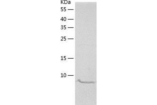 PROK2 Protein (AA 27-128) (His tag)