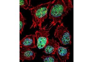 Immunofluorescence (IF) image for anti-Forkhead Box O6 (Foxo6) antibody (ABIN2996675) (Foxo6 antibody)