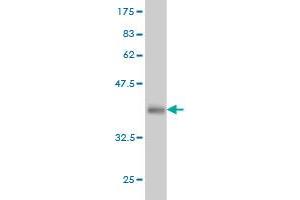 Western Blot detection against Immunogen (36. (IRAK2 antibody  (AA 111-210))