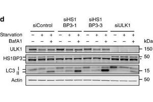 HS1BP3 is a negative regulator of autophagy. (HS1BP3 antibody  (C-Term))