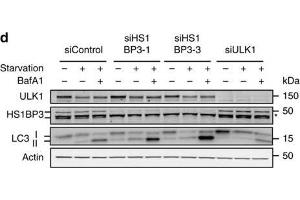 HS1BP3 is a negative regulator of autophagy. (HS1BP3 antibody  (C-Term))