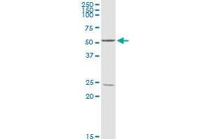 PPP2R2B MaxPab rabbit polyclonal antibody. (PPP2R2B antibody  (AA 1-443))