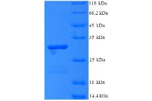 SDS-PAGE (SDS) image for Chemokine (C-X-C Motif) Ligand 1 (Melanoma Growth Stimulating Activity, Alpha) (CXCL1) (AA 1-131), (full length) protein (His-SUMO Tag) (ABIN5711171) (CXCL1 Protein (AA 1-131, full length) (His-SUMO Tag))