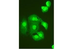 Immunocytochemistry on HeLa Cell (TNFAIP1 antibody  (N-Term))