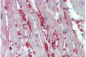 Human Heart: Formalin-Fixed, Paraffin-Embedded (FFPE) (alpha 1 Adrenergic Receptor antibody  (AA 206-270))