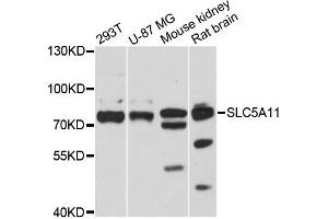 Western blot analysis of extracts of various cell lines, using SLC5A11 antibody (ABIN6289952) at 1:3000 dilution.