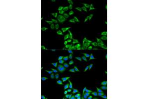 Immunofluorescence (IF) image for anti-Charged Multivesicular Body Protein 2B (CHMP2B) antibody (ABIN1876587)