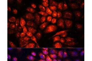 Immunofluorescence analysis of HeLa cells using UCP3 Polyclonal Antibody at dilution of 1:100. (UCP3 antibody)