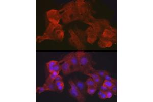 Immunofluorescence analysis of HepG2 cells using Villin1 Rabbit mAb (ABIN7271323) at dilution of 1:100 (40x lens).
