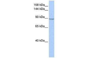 Hexokinase 2 antibody used at 1 ug/ml to detect target protein. (Hexokinase 2 antibody  (N-Term))