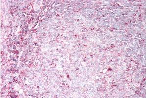 Immunohistochemistry (IHC) image for anti-Major Histocompatibility Complex, Class I, B (HLA-B) (AA 132-143) antibody (ABIN5539557)