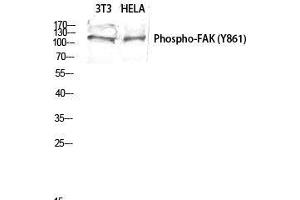 Western Blot (WB) analysis of 3T3 HeLa lysis using Phospho-FAK (Y861) antibody. (FAK antibody  (pTyr861))