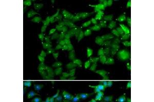 Immunofluorescence analysis of U2OS cells using PRKAB2 Polyclonal Antibody (PRKAB2 antibody)