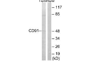 Western blot analysis of extracts from HepG2 cells, using CD91 (Ab-4520) antibody. (LRP1 antibody  (Ser4520))