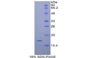 SDS-PAGE (SDS) image for Retinol Binding Protein 7, Cellular (RBP7) (AA 1-134) protein (His tag) (ABIN1821782)