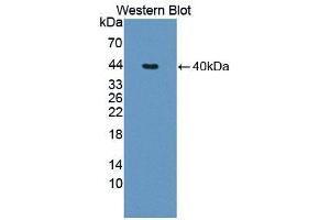 Western blot analysis of the recombinant protein. (TNNT1 antibody  (AA 1-261))