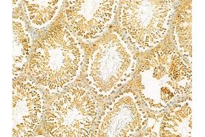 ABIN6264964 and ABIN6273072 at 1/100 staining Rat testis tissue by IHC-P. (SECISBP2 antibody  (Internal Region))