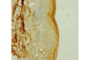 Immunohistochemistry (IHC) image for anti-Docking Protein 1, 62kDa (Downstream of tyrosine Kinase 1) (DOK1) (AA 1-481) antibody (ABIN7150562)