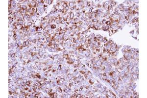 Immunohistochemistry (IHC) image for anti-Hypoxia Up Regulated 1 (HYOU1) (C-Term) antibody (ABIN2855339)