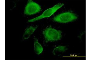 Immunofluorescence of monoclonal antibody to CDK4 on HeLa cell. (CDK4 antibody  (AA 211-303))