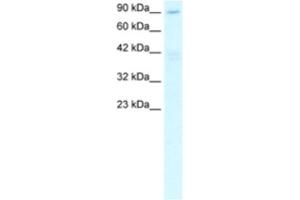 Western Blotting (WB) image for anti-Chromosome 20 Open Reading Frame 194 (C20orf194) antibody (ABIN2460292)