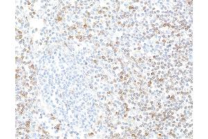 Immunohistochemistry (IHC) image for anti-Interleukin 7 Receptor (IL7R) (AA 21-236) antibody (ABIN7453897) (Recombinant IL7R antibody  (AA 21-236))