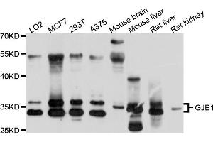 Western blot analysis of extracts of various cell lines, using GJB1 antibody (ABIN4903766) at 1:1000 dilution.