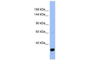 FANCA antibody used at 1 ug/ml to detect target protein. (FANCA antibody  (N-Term))