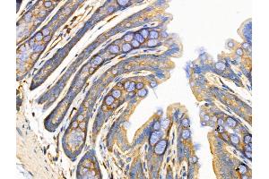 ABIN6258512 and ABIN6274729 at 1/100 staining Rat stomach tissue by IHC-P. (MRPL13 antibody  (C-Term))