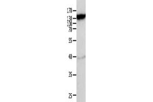 Gel: 10 % SDS-PAGE, Lysate: 40 μg, Lane: Mouse heart tissue, Primary antibody: ABIN7189591(ABCC5 Antibody) at dilution 1/950, Secondary antibody: Goat anti rabbit IgG at 1/8000 dilution, Exposure time: 10 minutes (ABCC5 antibody)