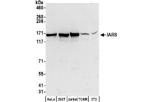 Western Blotting (WB) image for anti-Isoleucyl-tRNA Synthetase (IARS) (AA 1212-1262) antibody (ABIN7450348)
