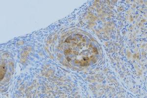 ABIN6268949 at 1/100 staining Human uterus tissue by IHC-P. (CXCL1 antibody  (Internal Region))