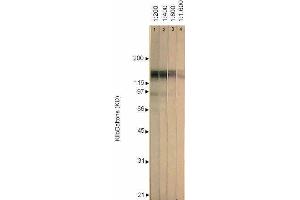 Western Blotting (WB) image for anti-Herpes Simplex Virus Type 1 ICP4 (HSV1 ICP4) antibody (ABIN265556)
