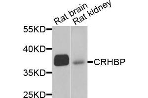 Western blot analysis of extracts of rat brain and rat kidney cells, using CRHBP antibody.