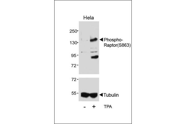 RAPTOR antibody  (pSer863)